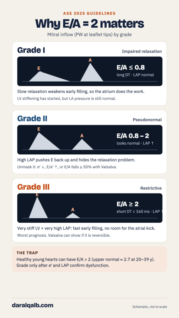 Schematic mitral inflow Doppler patterns for Grade I impaired relaxation, Grade II pseudonormal and Grade III restrictive filling